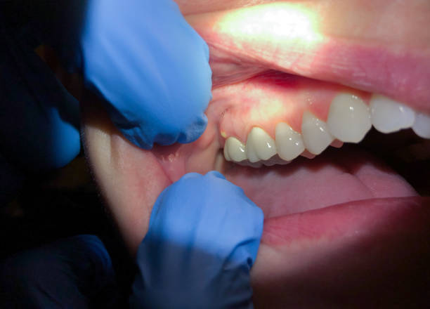 Best Orthodontic Emergency Dentist in Anderson, IN